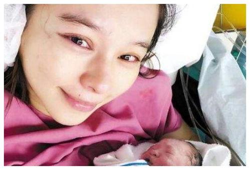 明星为什么选择剖腹产,安全与健康的双重保障